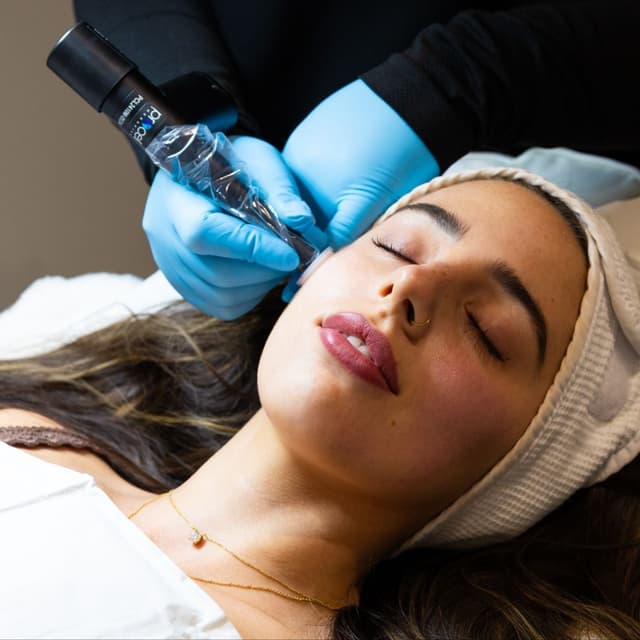 Procell Series of 6: Face & Neck at Esthetic Ritual in Portland, OR